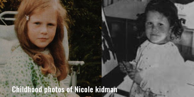 childhood photos of nicole kidman