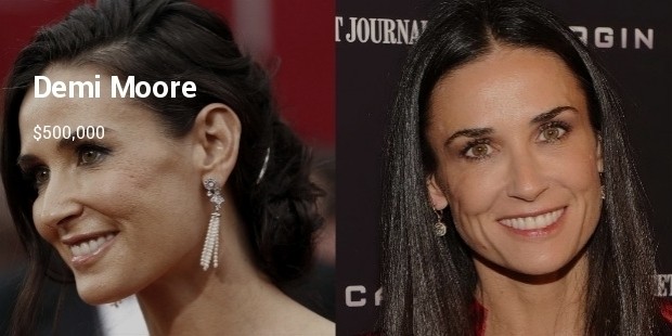 demi moore plastic surgery3