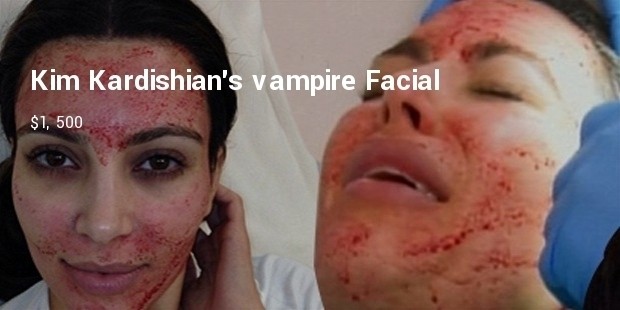 kim kardishians vampire facial 