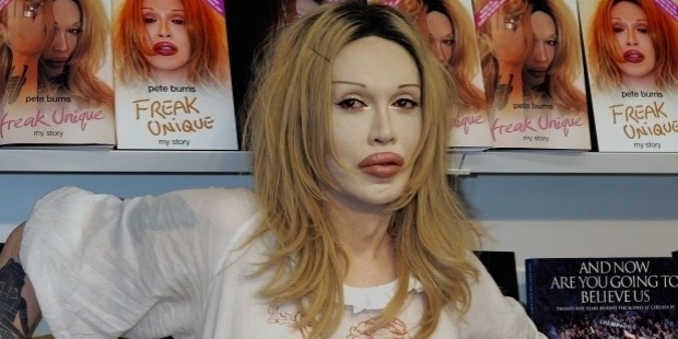 pete burns profile